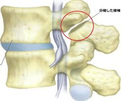 南行徳腰痛改善はエコルスタはり・きゅう整骨院で.jpg